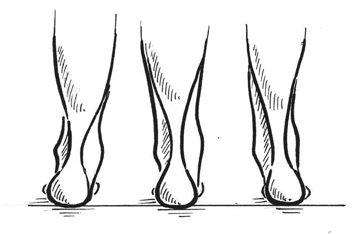 Immagine: Piede sinistro da dietro; a sinistra: pronazione, centro: posizione normale del piede, destra: supinazione